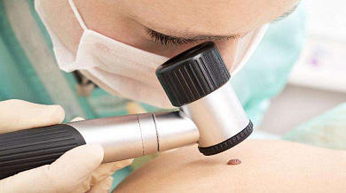 Grupovina Euromedik: Pregled svih mladeža na telu sa dermatoskopijom!  Popusti