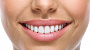Grupovina | Akcije, Popusti i Kuponi za Lepotu Dental studio Identity: Uklanjanje kamenca i poliranje zuba! Popusti