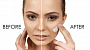 Grupovina | Akcije, Popusti i Kuponi za Lepotu Anti age tretman lica u salonu Lady 9! Popusti