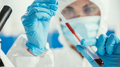 Millenium Medic: Biohemijska analiza krvi!