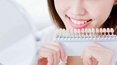 Grupovina | Akcije, Popusti i Kuponi za Lepotu Izbeljivanje zuba laserom - 6 tretmana! Popusti