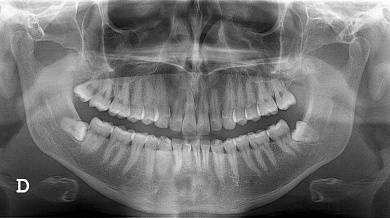 Medical Dental Grupa: Ortopan!