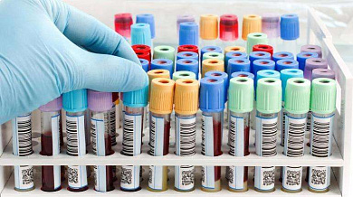 Talija lab: Analiza krvne slike, biohemije i hormona T3, T4 i TSH!