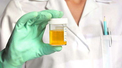 Labomedica: Analiza krvi i urina!